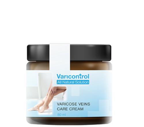 VariControl – spune la revedere de la varice